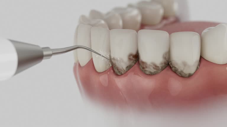 Reliable Dental Implants contractor in Marlow, OK by Smile Center Dentistry